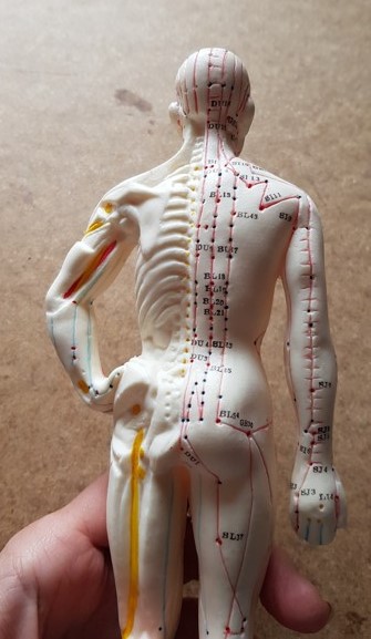 model-akupunktura